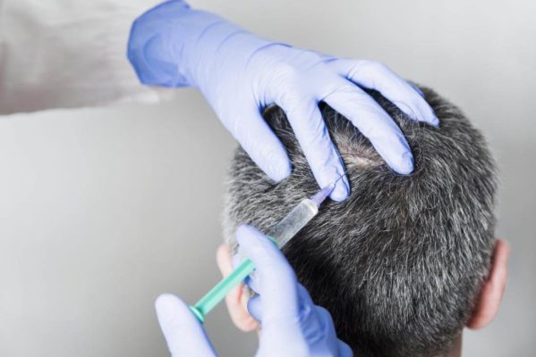 الموارد البشرية متلازمة بسلاسة  علاج الشعر الابيض طبياً ونهائياً