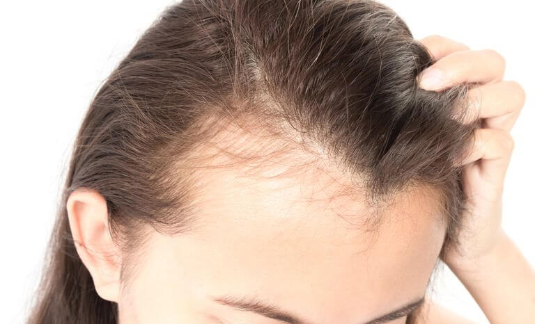 علاج الشعر الخفيف من الامام للنساء
